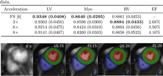 Figure 3 for Joint Motion Estimation and Segmentation from Undersampled Cardiac MR Image
