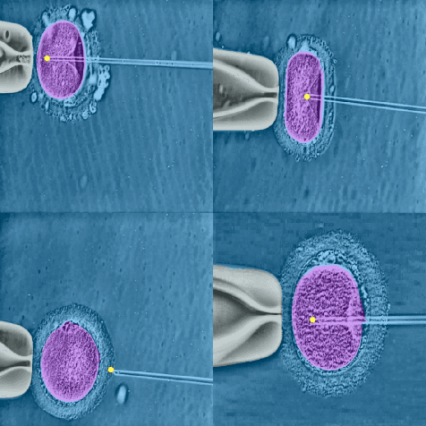 Figure 3 for Semantic Video Segmentation for Intracytoplasmic Sperm Injection Procedures