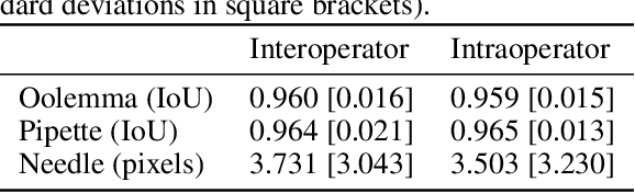 Figure 2 for Semantic Video Segmentation for Intracytoplasmic Sperm Injection Procedures