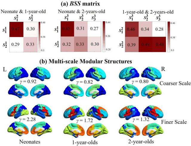 Figure 3 for Co-evolution of Functional Brain Network at Multiple Scales during Early Infancy