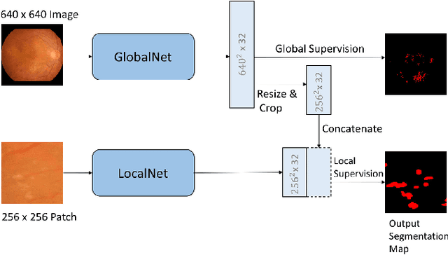 Figure 1 for Learning Mutually Local-global U-nets For High-resolution Retinal Lesion Segmentation in Fundus Images