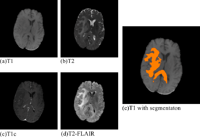 Figure 1 for BiTr-Unet: a CNN-Transformer Combined Network for MRI Brain Tumor Segmentation