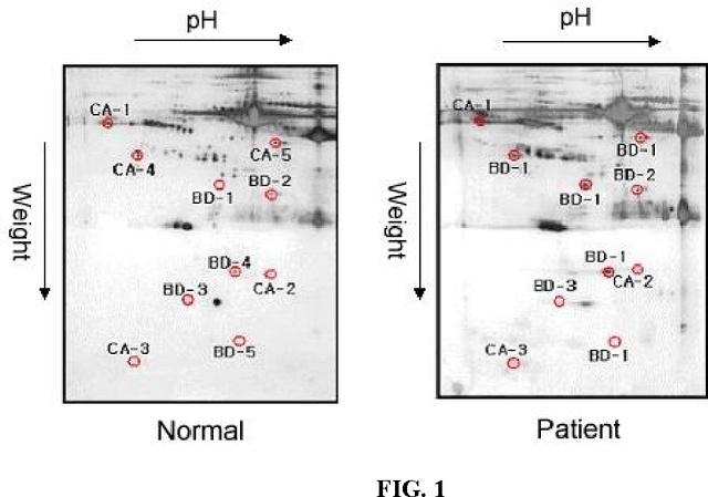 Figure 1 for 2D Electrophoresis Gel Image and Diagnosis of a Disease
