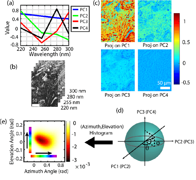 Figure 1 for Prostate cancer histopathology with label-free multispectral deep UV microscopy quantifies phenotypes of tumor grade and aggressiveness