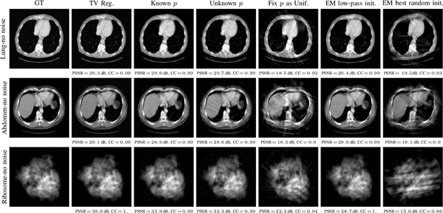 Figure 4 for An Adversarial Learning Based Approach for Unknown View Tomographic Reconstruction