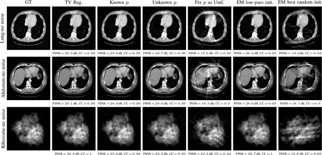 Figure 4 for An Adversarial Learning Based Approach for Unknown View Tomographic Reconstruction