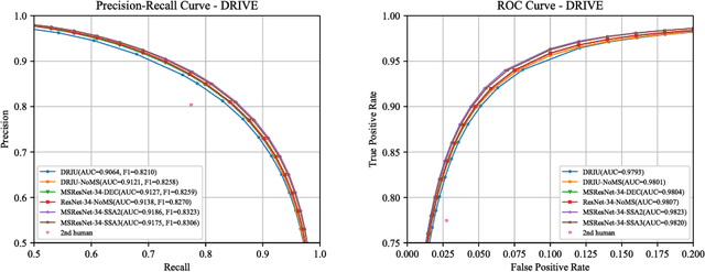 Figure 4 for Scale Space Approximation in Convolutional Neural Networks for Retinal Vessel Segmentation