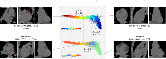 Figure 2 for Regression Metric Loss: Learning a Semantic Representation Space for Medical Images