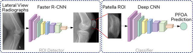 Figure 1 for Automated Detection of Patellofemoral Osteoarthritis from Knee Lateral View Radiographs Using Deep Learning: Data from the Multicenter Osteoarthritis Study (MOST)