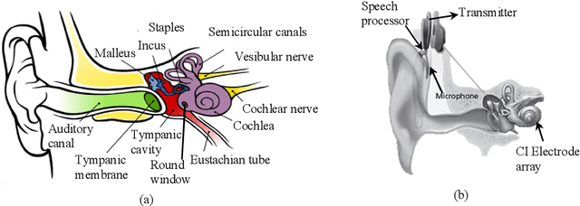 Figure 1 for Automatic techniques for cochlear implant CT image analysis