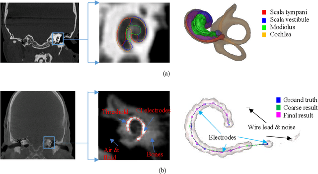 Figure 4 for Automatic techniques for cochlear implant CT image analysis