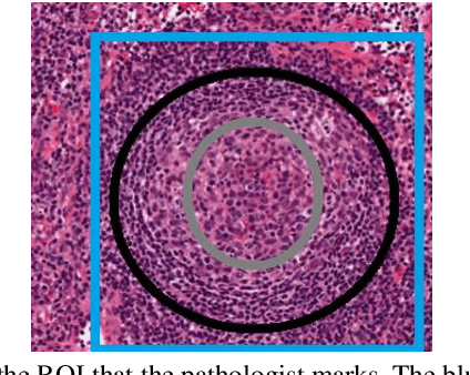 Figure 1 for RCNN for Region of Interest Detection in Whole Slide Images