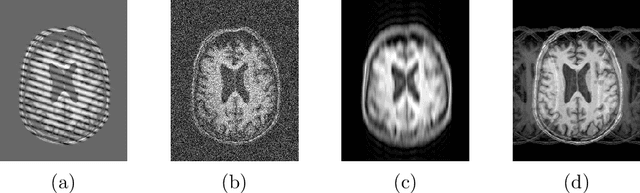 Figure 2 for A Heteroscedastic Uncertainty Model for Decoupling Sources of MRI Image Quality