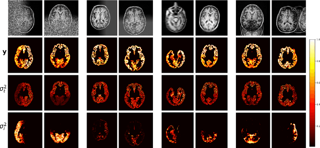 Figure 3 for A Heteroscedastic Uncertainty Model for Decoupling Sources of MRI Image Quality