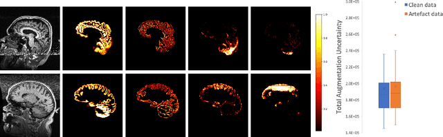 Figure 4 for A Heteroscedastic Uncertainty Model for Decoupling Sources of MRI Image Quality