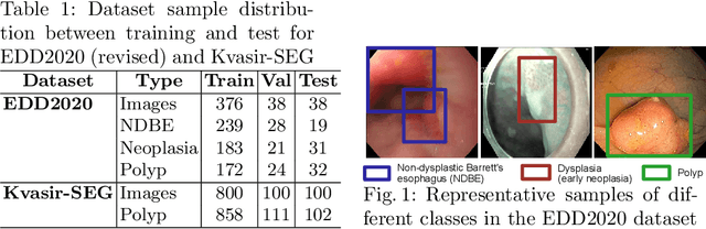 Figure 1 for Knowledge distillation with a class-aware loss for endoscopic disease detection