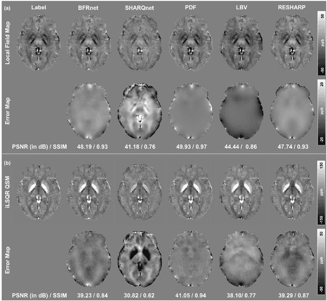 Figure 4 for BFRnet: A deep learning-based MR background field removal method for QSM of the brain containing significant pathological susceptibility sources