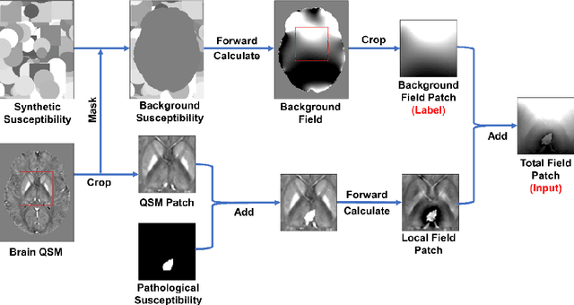 Figure 1 for BFRnet: A deep learning-based MR background field removal method for QSM of the brain containing significant pathological susceptibility sources