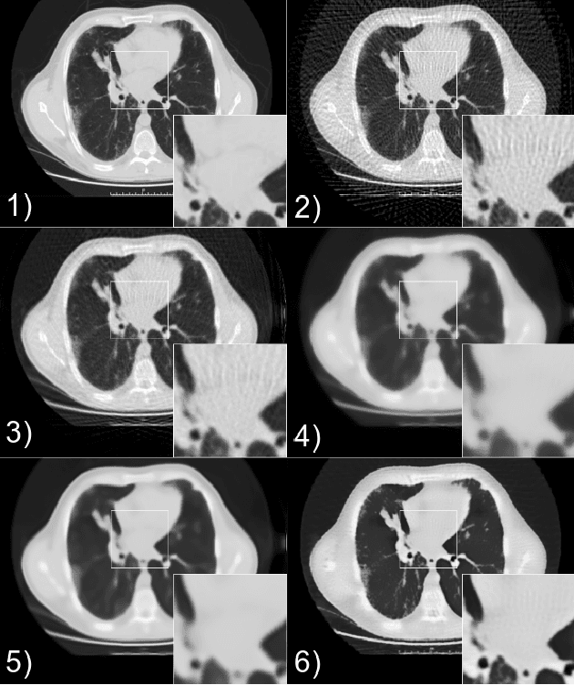 Figure 4 for Self-Supervised Training For Low Dose CT Reconstruction