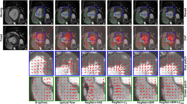 Figure 3 for Learning correspondences of cardiac motion from images using biomechanics-informed modeling