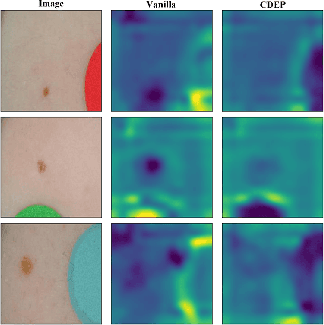 Figure 2 for Achievements and Challenges in Explaining Deep Learning based Computer-Aided Diagnosis Systems