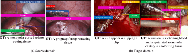 Figure 3 for Learning Domain Adaptation with Model Calibration for Surgical Report Generation in Robotic Surgery