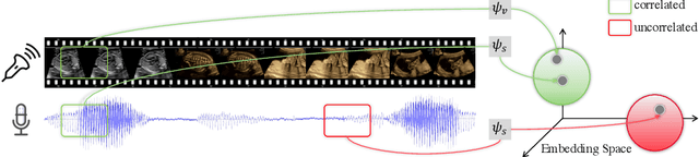 Figure 1 for Self-supervised Contrastive Video-Speech Representation Learning for Ultrasound