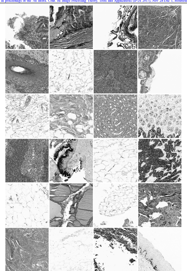 Figure 1 for Convolutional Neural Networks for Histopathology Image Classification: Training vs. Using Pre-Trained Networks