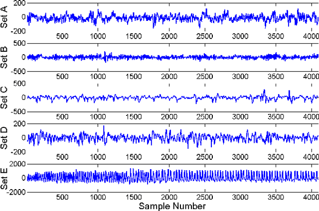 Figure 4 for Bag-of-Words Representation for Biomedical Time Series Classification