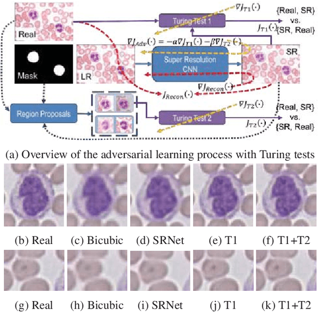 Figure 1 for Learning a Deep Convolution Network with Turing Test Adversaries for Microscopy Image Super Resolution