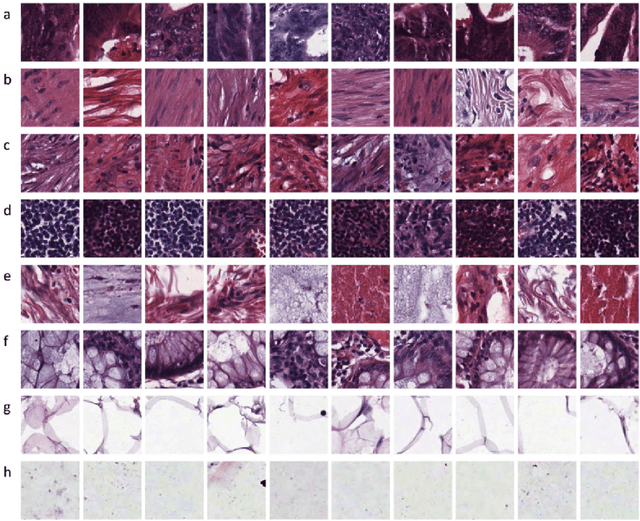 Figure 1 for Generalized Categorisation of Digital Pathology Whole Image Slides using Unsupervised Learning