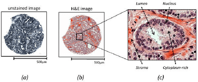 Figure 2 for Generalized Categorisation of Digital Pathology Whole Image Slides using Unsupervised Learning