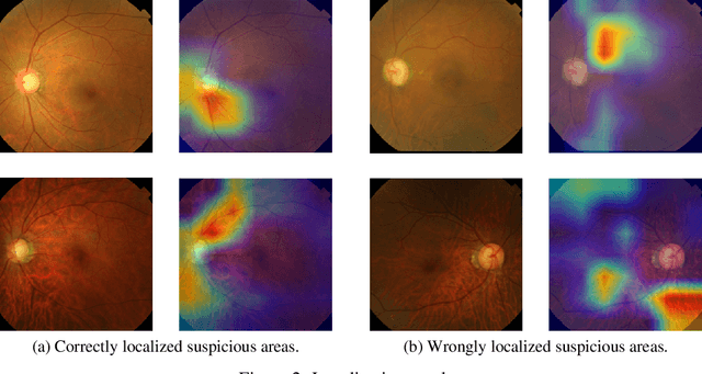 Figure 3 for Web Applicable Computer-aided Diagnosis of Glaucoma Using Deep Learning