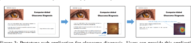 Figure 4 for Web Applicable Computer-aided Diagnosis of Glaucoma Using Deep Learning