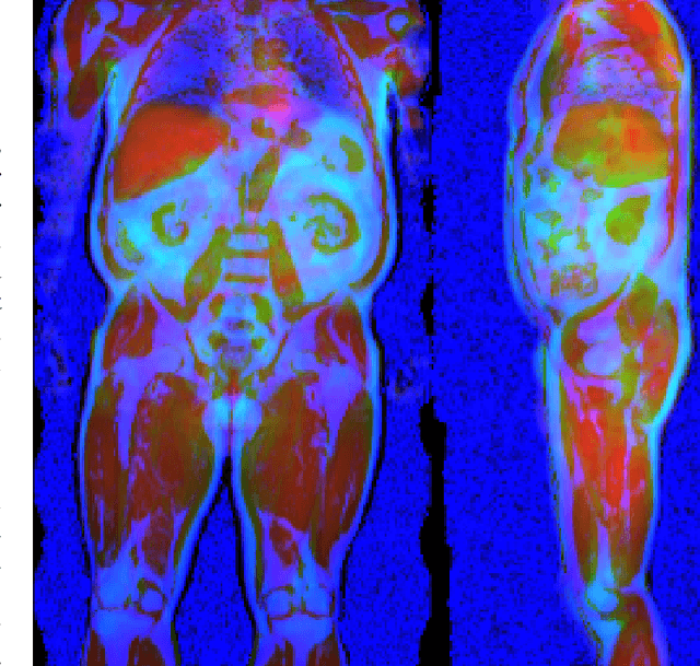 Figure 1 for Uncertainty-Aware Body Composition Analysis with Deep Regression Ensembles on UK Biobank MRI