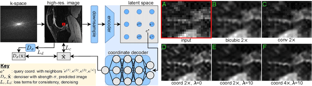 Figure 1 for Scale-Agnostic Super-Resolution in MRI using Feature-Based Coordinate Networks