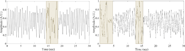 Figure 3 for Welch-GAN: Generating realistic photoplethysmography signal from frequency-domain for atrial fibrillation detection