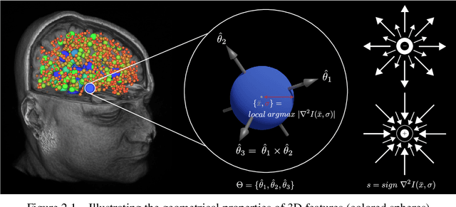 Figure 1 for Using Atom-Like Local Image Features to Study Human Genetics and Neuroanatomy in Large Sets of 3D Medical Image Volumes
