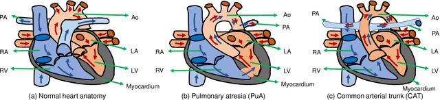 Figure 1 for Accurate Congenital Heart Disease ModelGeneration for 3D Printing