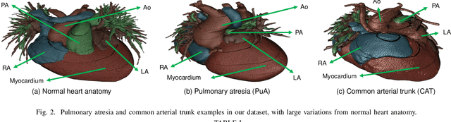 Figure 2 for Accurate Congenital Heart Disease ModelGeneration for 3D Printing