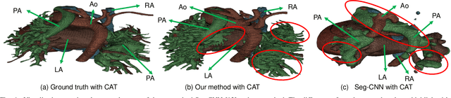 Figure 4 for Accurate Congenital Heart Disease ModelGeneration for 3D Printing