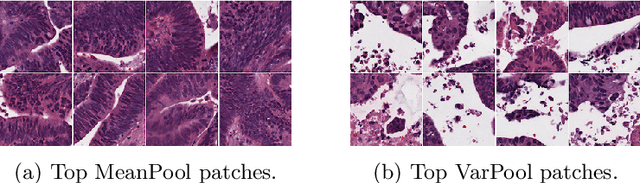 Figure 3 for Incorporating intratumoral heterogeneity into weakly-supervised deep learning models via variance pooling