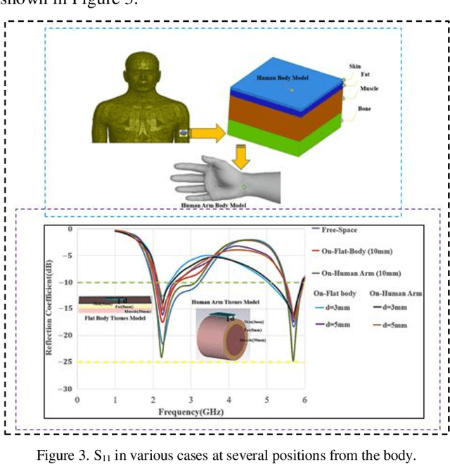 Figure 3 for Design of Flexible Meander Line Antenna for Healthcare for Wireless Medical Body Area Networks