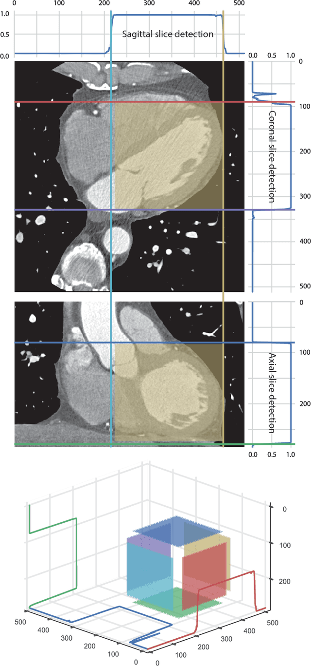 Figure 4 for ConvNet-Based Localization of Anatomical Structures in 3D Medical Images