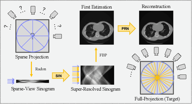 Figure 1 for 2-Step Sparse-View CT Reconstruction with a Domain-Specific Perceptual Network