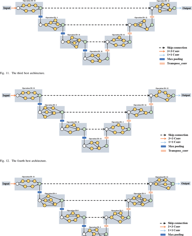 Figure 2 for Genetic U-Net: Automatically Designing Lightweight U-shaped CNN Architectures Using the Genetic Algorithm for Retinal Vessel Segmentation