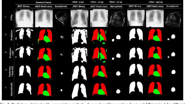 Figure 2 for Post-DAE: Anatomically Plausible Segmentation via Post-Processing with Denoising Autoencoders