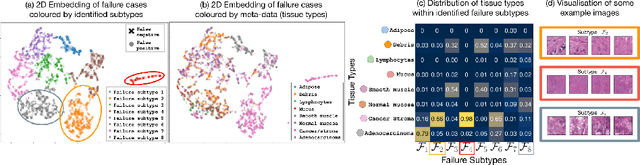 Figure 4 for A Principled Approach to Failure Analysis and Model Repairment: Demonstration in Medical Imaging