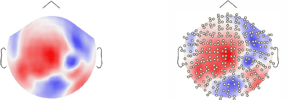 Figure 1 for Deep neural networks on graph signals for brain imaging analysis