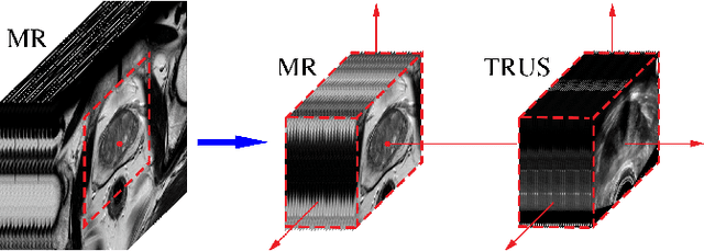 Figure 1 for Learning Multi-Modal Volumetric Prostate Registration with Weak Inter-Subject Spatial Correspondence